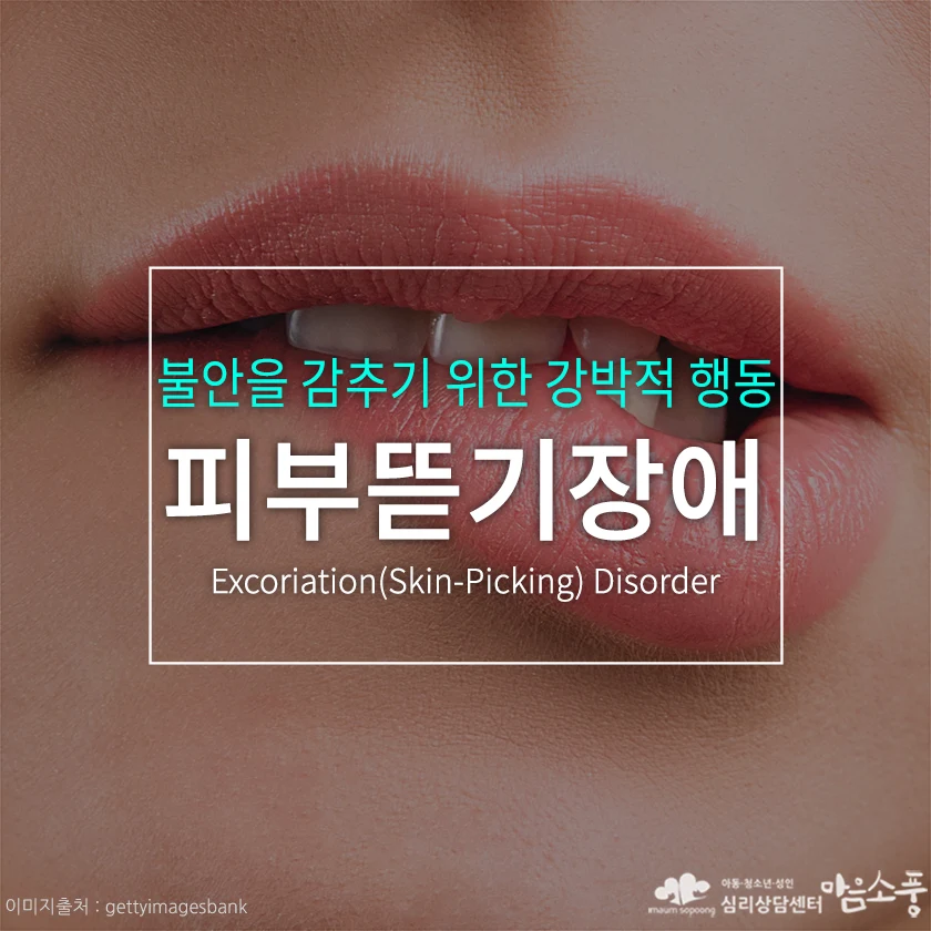 피부뜯기장애, 불안을 감추기 위한 강박적 행동